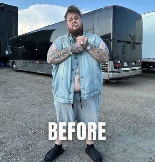 Country Singer Jelly Roll Shed 100 Pounds – Wait Till You See How He Looks Now…